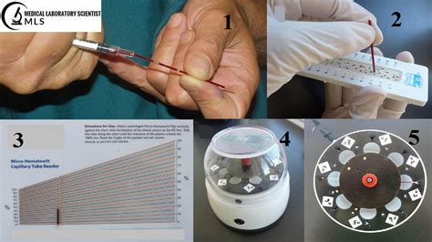 hematocrit procedure step by